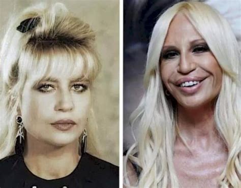 donatella versace e la chirurgia|donatella versace face what happened.